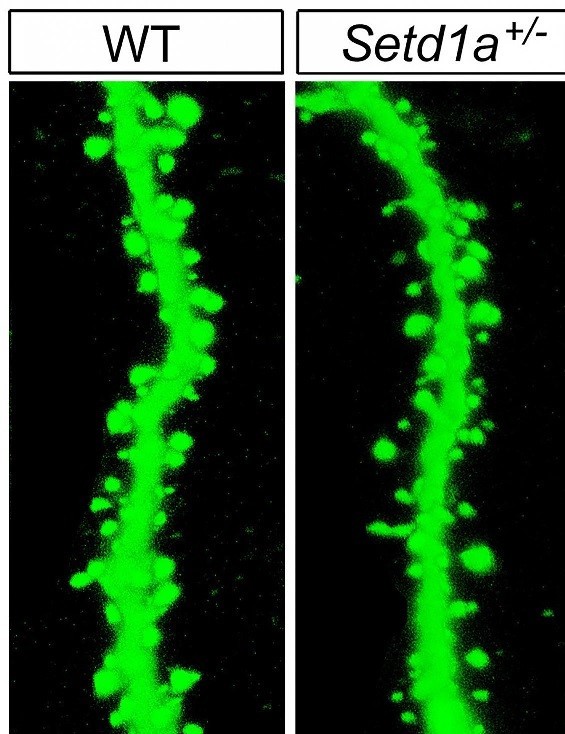 Mutant mice with impaired function of the SETD1A gene showed abnormalities in the neuronal machinery by which brain cells communicate. For example, there were fewer-than-normal spines (right), needed to relay signals, on branches of neurons. Jun Mukai/Gogos Lab/Columbia’s Zuckerman Institute