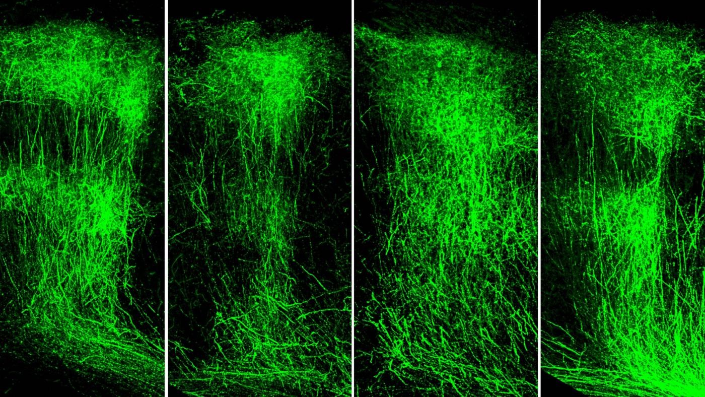 Representative images of axon branching of WT (normal) mice (left) compared to SETD1A-deficient mice (left center). SETD1A-deficient mice injected with an LSD1 inhibitor (right center) rescued axonal growth to near-normal levels and counteracted the behavioral deficits. The LSD1 inhibitor had no effect on WT mice (right) (Credit: Jun Mukai/Gogos lab/Columbia's Zuckerman Institute).