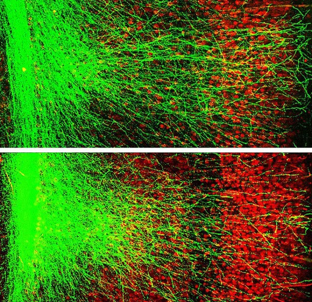 Neurons in mice with the genetic mutation (top) are stunted in growth, compared to the neurons in healthy mice (bottom).