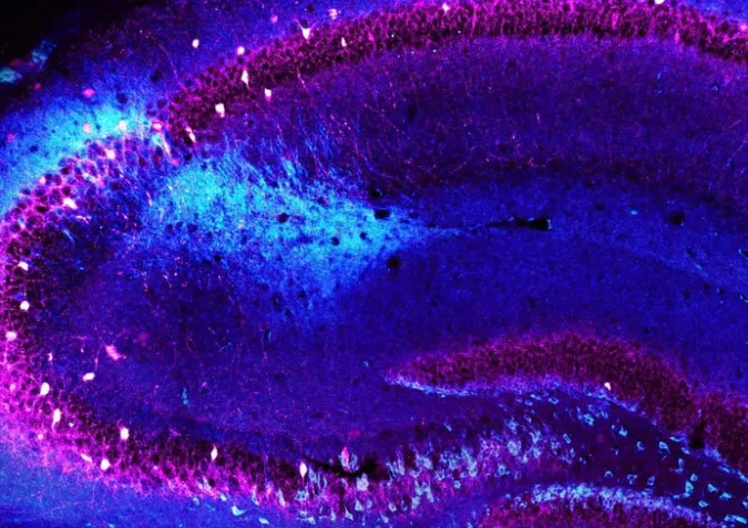 Hippocampus