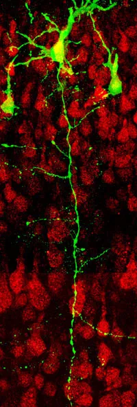 Ipsi Axon (1).jpg
