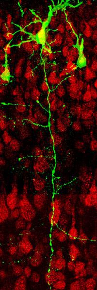 Ipsi Axon (1)