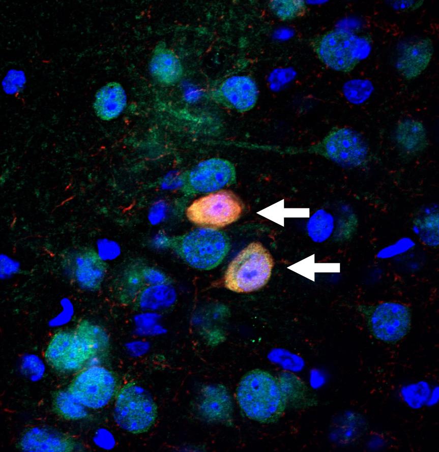 GABA-producing neurons in the brain (marked by arrows) that contain PRODH, the enzyme responsible for flushing out excess L-proline. When PRODH is defective, L-proline levels in the brain rise, resulting in disruptions of gamma oscillations that normally help orchestrate and organize thought processes. Disrupted gamma oscillations have been observed in a number of psychiatric disorders, including schizophrenia (Credit: Gregg Crabtree/Gogos Lab/Columbia's Zuckerman Institute). GABA-producing neurons in the brain